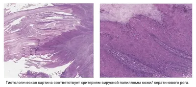 Комплекс эозинофильной гранулемы кошек | Ветеринарная клиника доктора Шубина