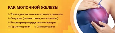 Рак молочной железы 4 стадия: симптомы, диагностика, лечение рака молочной  железы 4 стадии - Онкоцентр «Добрый прогноз»