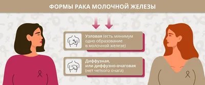 Можно ли диагностировать у себя рак груди?