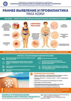 Немеланомный рак кожи: диагностика и лечение