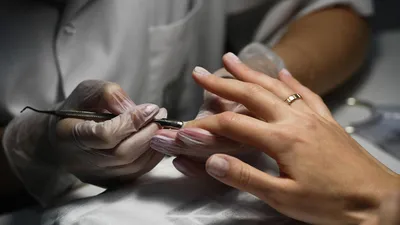 Онколог рассказал, как выявить рак по состоянию ногтей - Российская газета