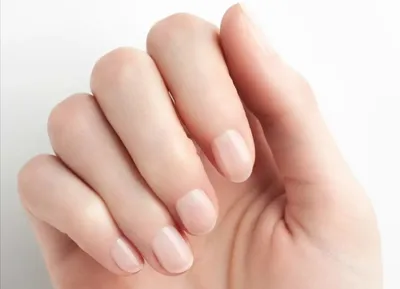 Черное пятно под ногтем – причины, лечение и способы профилактики