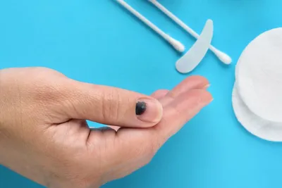 Ногти после химиотерапии: как восстановить, лечение грибка | Можно ли  покрывать ногти гель лаком при онкологии