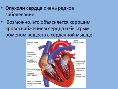 Из-за чего возникает рак сердца - Здоровье 24