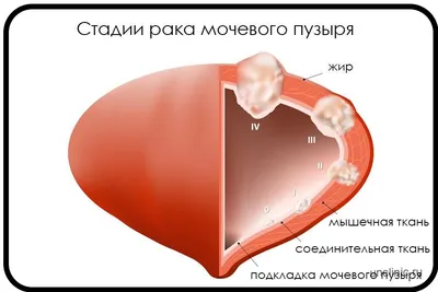 Рак, любовь, сердца, рак в розовом…» — создано в Шедевруме