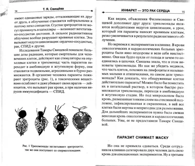 Рак лимфоузла у детей - лечение в Израиле онкология лимфоузлов у ребенка по  доступной цене, запись на диагностику детской опухоли лимфатических узлов в  Израильских клиниках