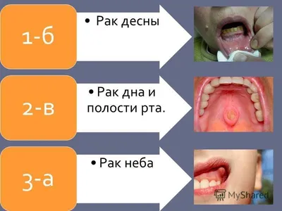 Томские ученые опробуют новый метод лечения онкологии на животных | Новости  России и мира | Дзен