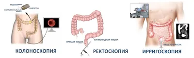 Плоскоклеточный рак кожи: симптомы, лечение | Семейный доктор