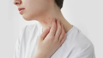 Проблемы с кожей: сыпь по всему телу и сильный зуд