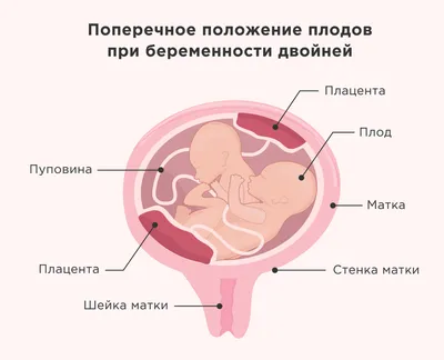 Анатомия сердца