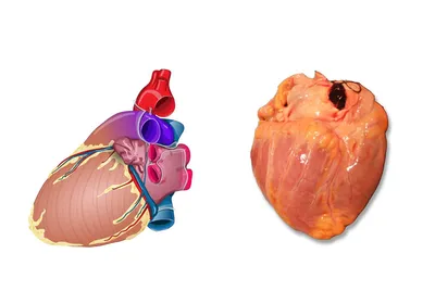 Благотворительный фонд \"Детские сердца\" - #ВПС_info Что происходит в сердце,  когда в нём сразу четыре нарушения? Речь идёт о тетрада Фалло — сложном  врожденном пороке сердца. Человек рождается одновременно с дефектом  межжелудочковой