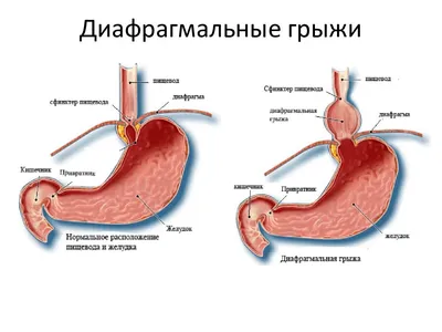 ➤ КТ грудной и брюшной полости в Киеве - Лайфскан