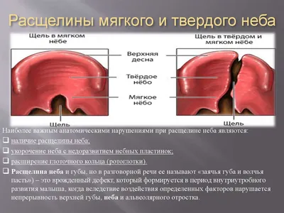 Причины, виды и диагностика расщелины мягкого неба у собак