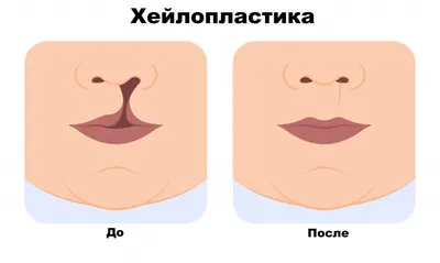 Восстановление расщелины губы и неба в Польше - 4 клиники, цены процедур,  отзывы | Clinics on Call