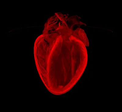 Разбитое сердце: Лучшие фото из мира кардиологии - Техно bigmir)net