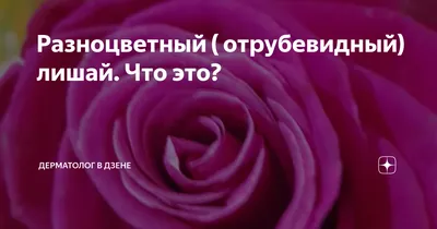 Чем лечить лишай? ~ Советы специалистов