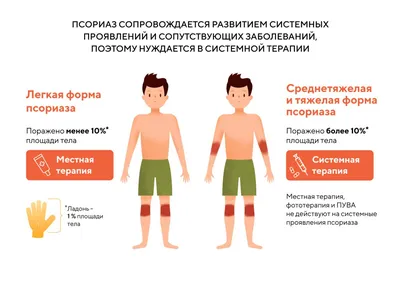 Псориаз - причины, симптомы, диагностика и лечение в Москве