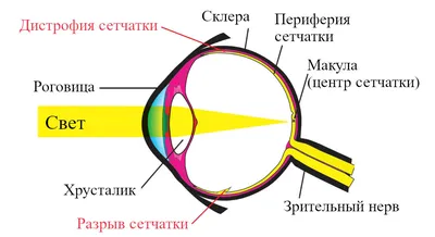 Основная информация: Отслоение сетчатки - Справочник MSD Версия для  потребителей