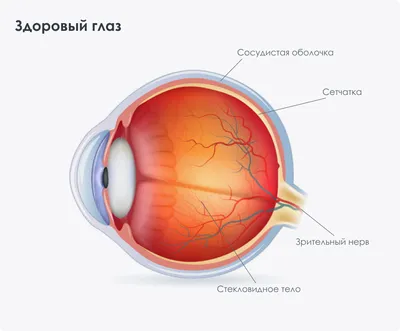 Лечение тромбоза центральной вены сетчатки: диагностика и лечение | Клиника  Санта