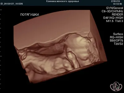 15 недель | Клиника ведения беременности в Пятигорске
