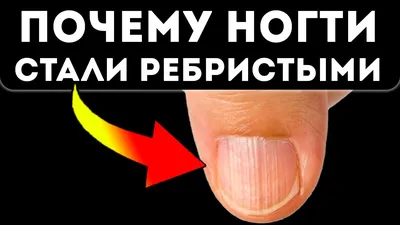 Слоятся ногти у ребёнка. — 2 ответов | форум Babyblog