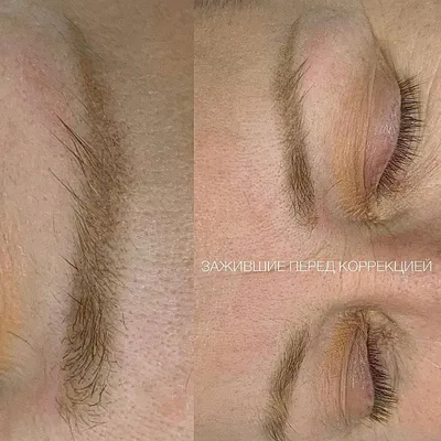 Татуаж бровей волосковый метод: фото до и после, плюсы и минусы, техника  выполнения, цены, отзывы