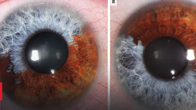 Какой цвет глаз самый редкий - у ученых есть ответ и объяснение, почему так