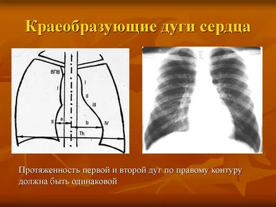 Рентген верхних конечностей цена в Москве метро Кантемировская, Каширская —  клиника Трит