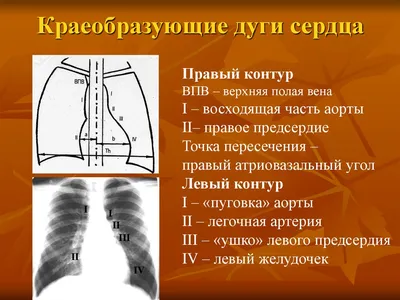 Детские сердца | Портал радиологов