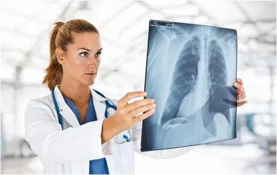 Рентген грудной клетки - рентгенография грудной клетки и органов в Москве