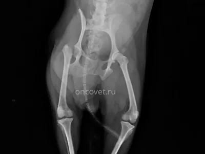 Рентгенография в Москве – сделать рентген по доступной цене в клинике  Семейный доктор