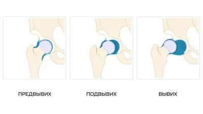 Дисплазия тазобедренных суставов у собак - Ветеринарный Центр «Прайд»