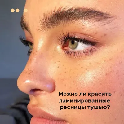 Почему болят глаза после наращивания ресниц | Первая глазная клиника в  Москве | Дзен