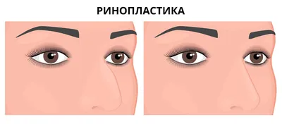 Несколько приемов коррекции длинного носа - BOYKO BEAUTY SCHOOL