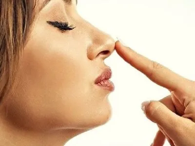 Ринопластика (пластика носа) – цена, фото до и после операции, отзывы  пациентов. Стоимость ринопластики в Москве - клиника Beauty Trend