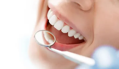 Полная прямая реставрация верхних центральных резцов - DENTALMAGAZINE.RU