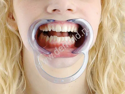 Spandex® ретрактор для щёк и губ, стандартный №605454