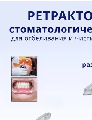 Ретрактор стоматологический универсальный JNB 2шт - купить в ООО Здоровье,  цена на Мегамаркет