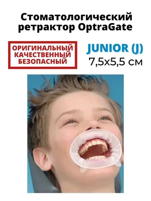 ОптраГейт ретрактор стоматологический для губ REGULAR 5 шт - купить с  доставкой по выгодным ценам в интернет-магазине OZON (1103534500)