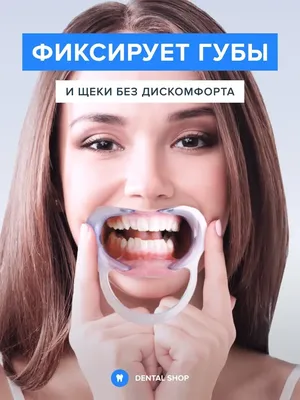Dental Shop Ретрактор стоматологический, Роторасширитель, Загубник