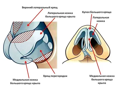 Фото до и после азиатской ринопластики | пластический хирург Аганесов Г.А.,  Москва