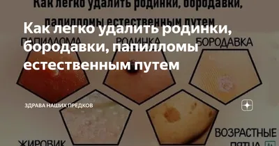 Что такое папилломы и как их лечить?