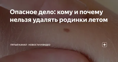 Удалить родинку в Лобне