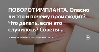 ПОВОРОТ ИМПЛАНТА. Опасно ли это и почему происходит? Что делать, если это  случилось? Советы пластического хирурга. | Елена Сухопарова — Пластический  хирург | Дзен