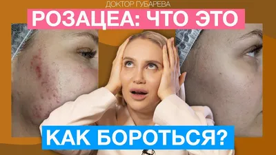 Капли для глаз от блефарита: когда необходимо применение антибиотика? -  энциклопедия Ochkov.net