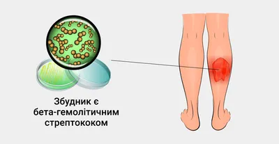 Розацеа – симптмы, причины, профилактика и лечения розовых угрей у взрослых  | «Будь Здоров»