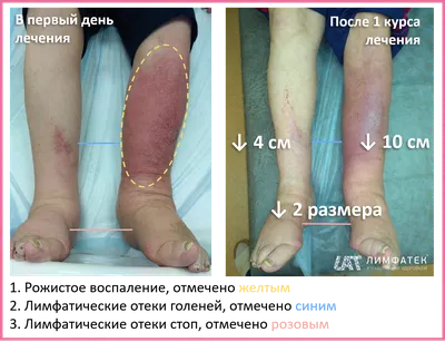 Ну здравствуй \"рожа\" | Я не сдамся без боя. | Дзен