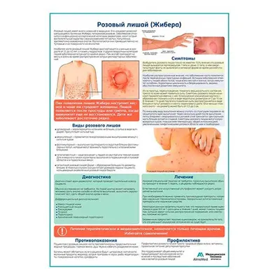 📌 Розовый лишай или питириаз Жибера. Сезон начался… тел: 87001002508  @dr.mukasheva #дерматолог #дерматологактау | Instagram