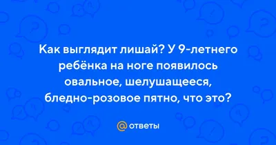 Лечение лишая на коже у взрослых: симптомы, разновидности, стоимость  лечения - Медицинский центр «Дезир» Санкт-Петербург.