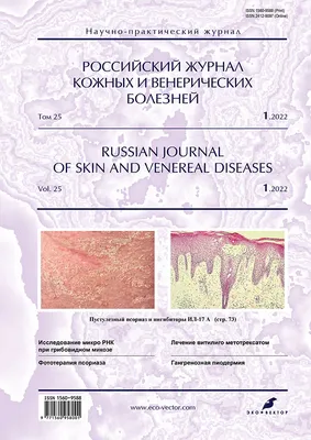 Лечение красного плоского лишая (Вильсона) в Киеве — Derma.ua